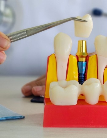 برنامج طب الأسنان - مسار نيو فيجين